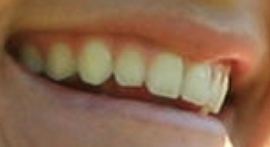 Picture of Lexi Thompson teeth and smile