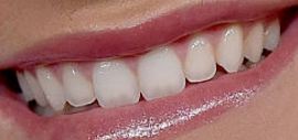 Picture of Lexi Thompson teeth and smile