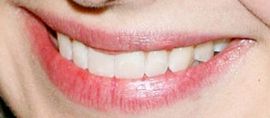 Picture of Alison Brie teeth and smile
