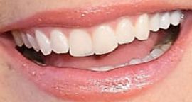 Picture of Alison Sweeney teeth and smile