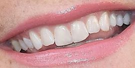 Picture of Alison Sweeney teeth and smile