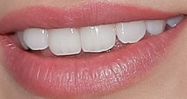 Picture of Alissa Violet teeth and smile