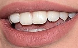 Picture of Alissa Violet teeth and smile
