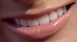 Picture of Ally Brooke teeth and smile