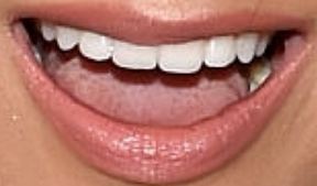 Picture of Ally Brooke teeth and smile