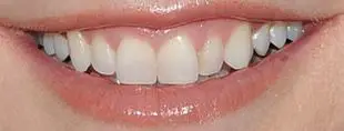 Picture of Alyson Hannigan teeth