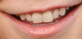 Picture of Alyson Hannigan teeth
