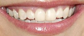 Picture of Amanda Bynes teeth and smile