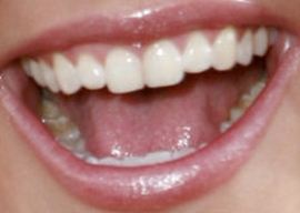 Picture of Amanda Bynes teeth and smile