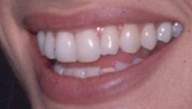 Picture of Amanda Peet teeth and smile