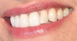 Picture of Amanda Peet teeth and smile