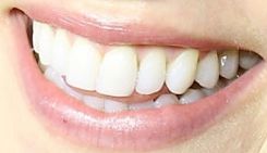 Picture of Amanda Schull teeth and smile