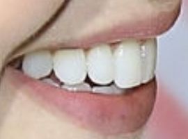 Picture of Amanda Schull teeth and smile