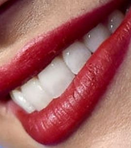 Picture of Amber Heard teeth and smile