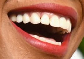 Picture of Amber Ruffin teeth and smile