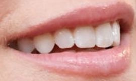 Picture of Amy Adams teeth and smile