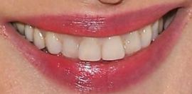 Picture of Andie MacDowell teeth and smile