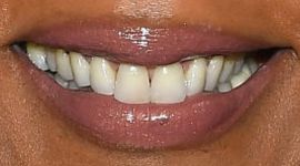 Picture of Angela Bassett teeth and smile