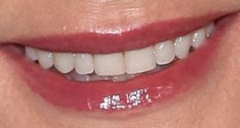 Picture of Angela Kinsey teeth and smile