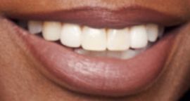 Picture of Angelica Ross teeth and smile
