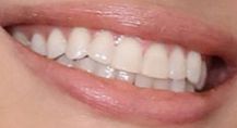 Angelina Jolie's teeth and smile