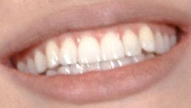 Angelina Jolie's teeth and smile