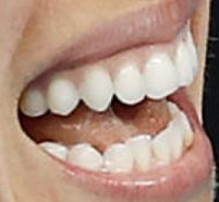 Picture of Angelique Kerber's teeth and smile and smile