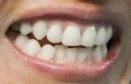 Picture of Angelique Kerber's teeth and smile and smile