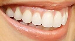 Picture of Anna Camp teeth
