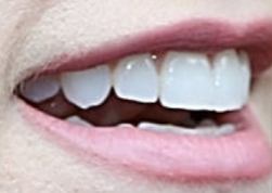 Picture of Anna Kendrick teeth