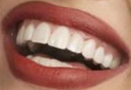 Picture of Anna Zak teeth and smile