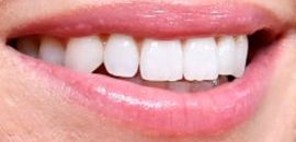 Picture of Annabelle Wallis teeth and smile