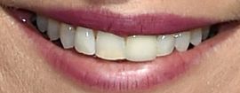 Picture of Annie Mumolo teeth and smile