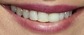 Picture of Annie Mumolo teeth and smile