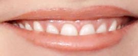 Picture of Annie Murphy teeth and smile