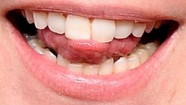Picture of Annie Murphy teeth and smile
