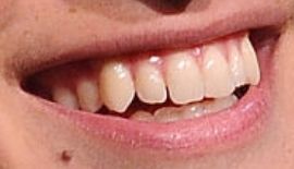 Picture of Ansel Elgort teeth and smile