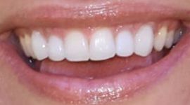 Picture of Arianne Zucker teeth and smile