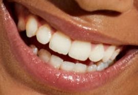 Picture of Arica Himmel teeth and smile