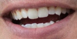 Picture of Arie Luyendyk Jr. teeth and smile