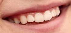 Picture of Asher Angel teeth and smile