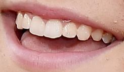 Picture of Asher Angel teeth and smile