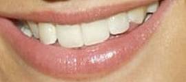 Picture of Ashlee Simpson teeth and smile