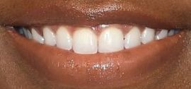 Picture of Ashleigh Murray teeth and smile