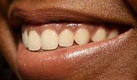 Picture of Ashleigh Murray teeth and smile