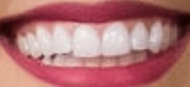 Picture of Ashley Darby teeth and smile