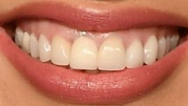 Picture of Ashley Graham teeth and smile