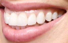 Picture of Ashley Graham teeth and smile