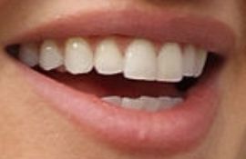 Picture of Ashley Roberts teeth and smile