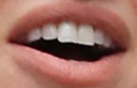 Picture of Ashley Roberts teeth and smile